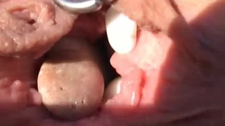 Сучка засовывает камни в киску